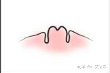 乳头内陷手术价格详解，探究与洞察